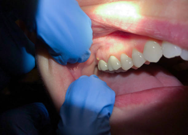 Best Orthodontic Emergency Dentist in Cressona, PA
