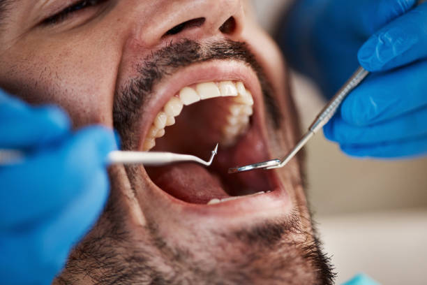 Best Mobile Emergency Dentist in Cressona, PA
